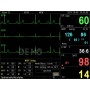 PC-3000 Multiparametrový monitor