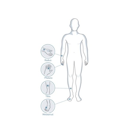 Mini omni sunlight - densytometr kostny z sondą cm i oprogramowaniem