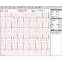 Brezžični pc-ekg elektrokardiograf euro ecg bt12