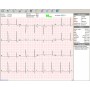 Bezdrátový PC-EKG elektrokardiograf Euro ECG BT12