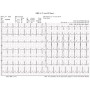 Draadloze pc-ecg-elektrocardiograaf euro ecg bt12