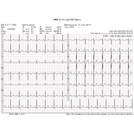 Électrocardiographe pc-ecg sans fil euro ecg bt12