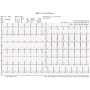 Bezdrátový PC-EKG elektrokardiograf Euro ECG BT12