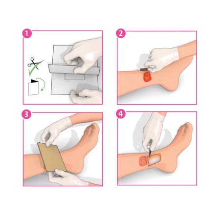 Inadine (pvp-i) non-adherent dressing p01481, 5 cm x 5 cm - 25 pcs.