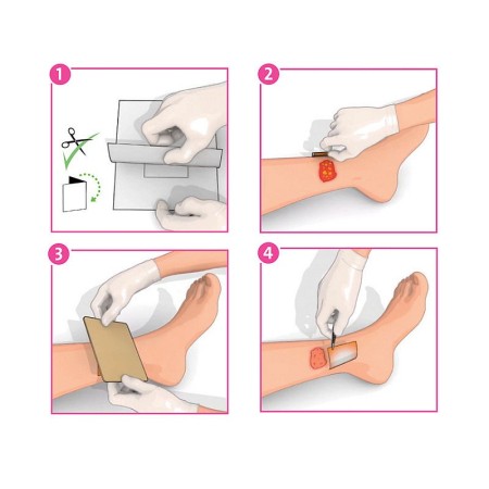 Inadine (pvp-i) nicht haftender wundverband p01491, 9,5 cm x 9,5 cm - 10 stück.