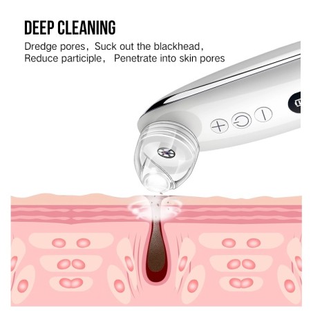 Aspira punti neri con telecamera microscopio per smartphone