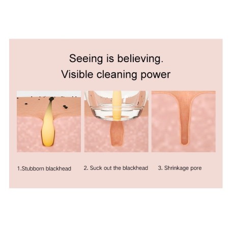 Aspira punti neri con telecamera microscopio per smartphone