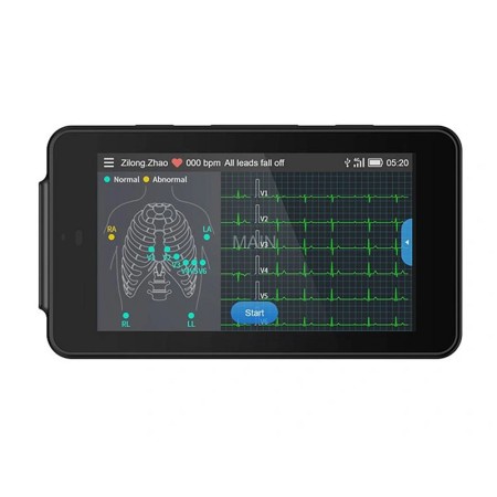 Pcecg-500 electrocardiograf portabil de buzunar cu interpretare glasgow