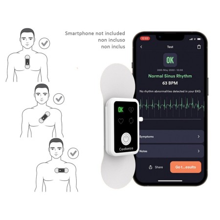 1-kanaals cardionisch ecg met afib en bluetooth