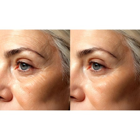 Ultrasuoni per la bellezza ultrasonicwaves beauty dotazione viso e decollete