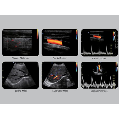 Ecografo a colori chison eco6 - 2 connettori sonda