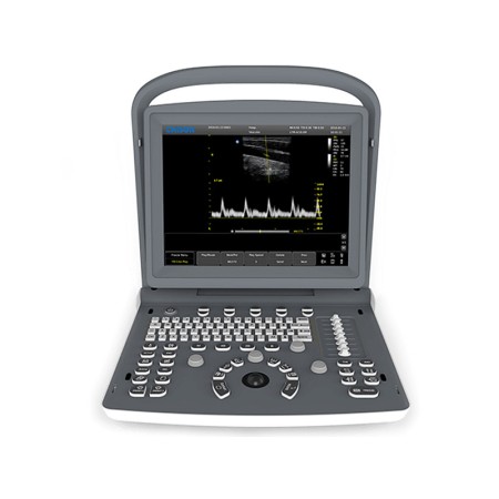 Ecografo chison eco2 b/n - 1 connettore sonda