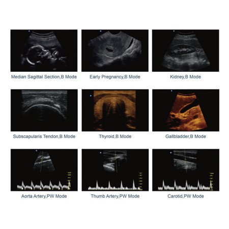 Czarno-biały skaner ultradźwiękowy chison eco2 - 1 złącze sondy