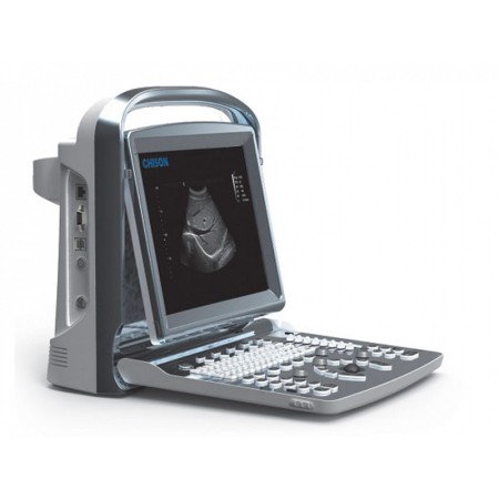 Ecografo b/n chison eco1 - 1 connettore sonda, versione lineare 5-12 mhz - l40