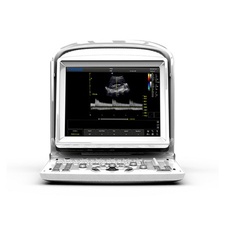 Skaner ultradźwiękowy chison eco3 b/w - 2 złącza sond, wersja liniowa 5 - 12 mhz - l40