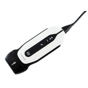 Sonoeye p2 cyfrowy doppler kolorowy - sonda liniowa