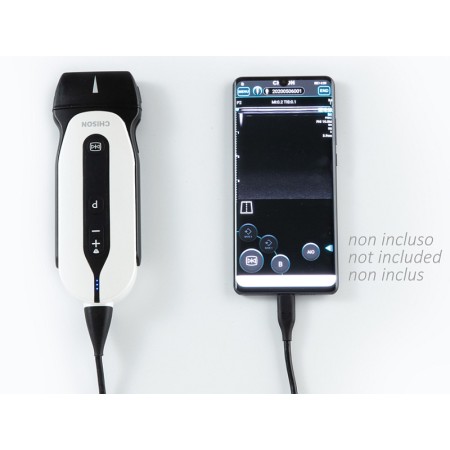 Sonoeye p2 color digital doppler - linear array probe