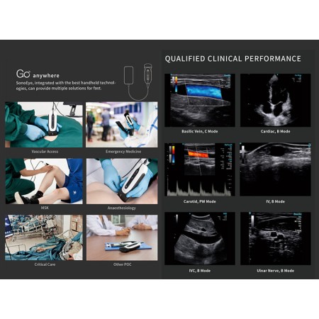 Sonoeye p2 doppler digitale a colori - sonda linear array