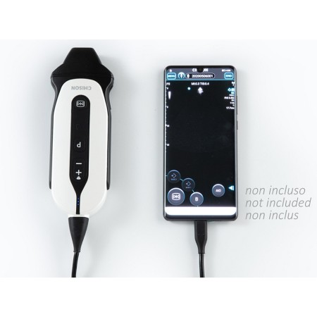 Sonoeye p3 farve digital doppler - fasearray-probe
