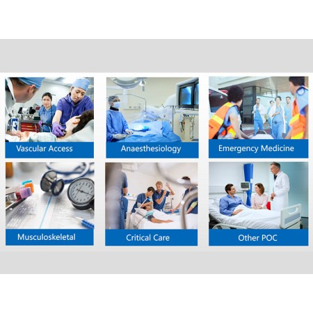 Sonoeye p3 doppler digitale a colori - sonda phase array