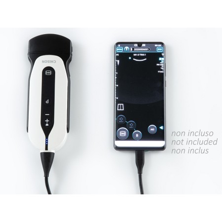 Sonoeye p5 cyfrowy kolorowy doppler - sonda wypukła