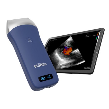 Ecografo portatile lineare wireless viatom