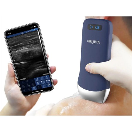 Ecografo portatile lineare wireless viatom