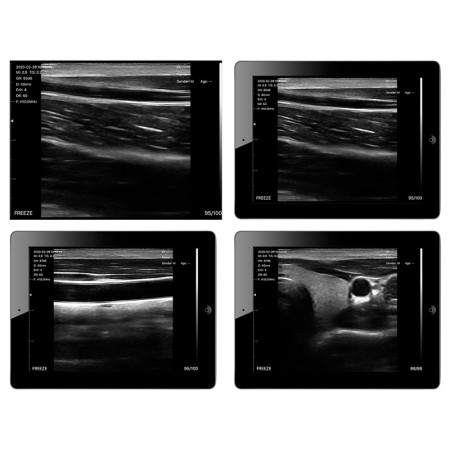Ecografo portatile lineare wireless viatom