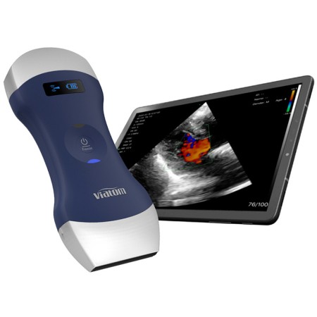 Ecografo portatile lineare/convesso doppia testa wireless viatom