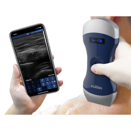 Ecografo portatile lineare/convesso doppia testa wireless viatom