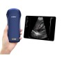 Ecografo portatile lineare/convesso/cardiaco 3 in 1 wireless viatom