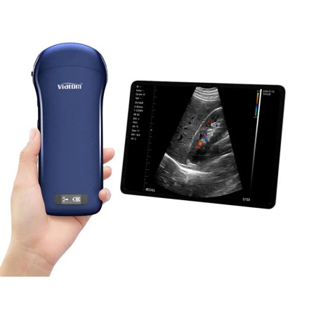 Ecografo portatile lineare/convesso/cardiaco 3 in 1 wireless viatom