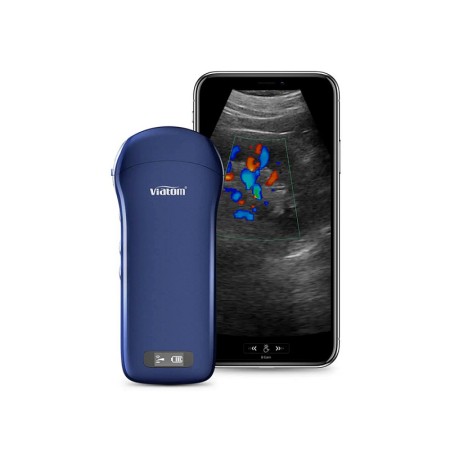 Ecografo portatile lineare/convesso/cardiaco 3 in 1 wireless viatom