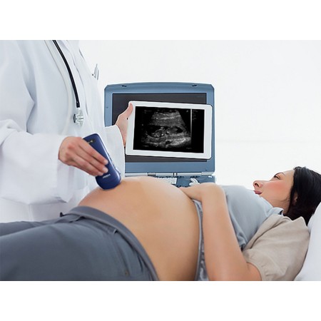 Ecografo portatile lineare/convesso/cardiaco 3 in 1 wireless viatom