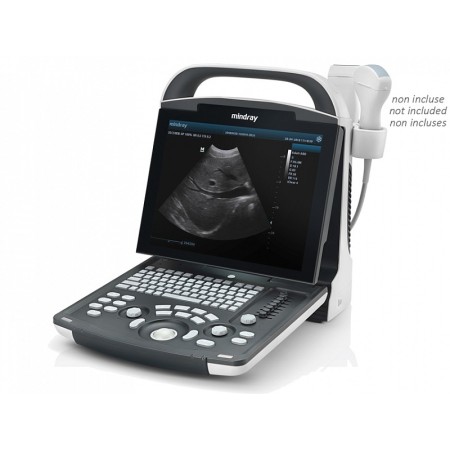Mindray dp-20 ultrasound scanner
