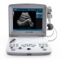 Przenośny ultrasonograf eco - doppler dus 60 - ekran 12,1" - 2 złącza sondy