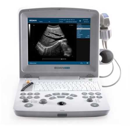 Przenośny ultrasonograf eco - doppler dus 60 - ekran 12,1" - 2 złącza sondy