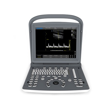 Skaner ultrasonograficzny chison eco - 2 weterynarze - 1 złącze