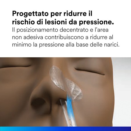Sistema di fissaggio per sondino nasogastrico 3m 1501ng misura m - 100 pz.