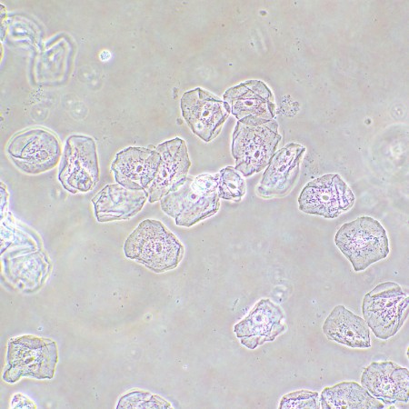 Dispositivo a contrasto di fase magus sph2