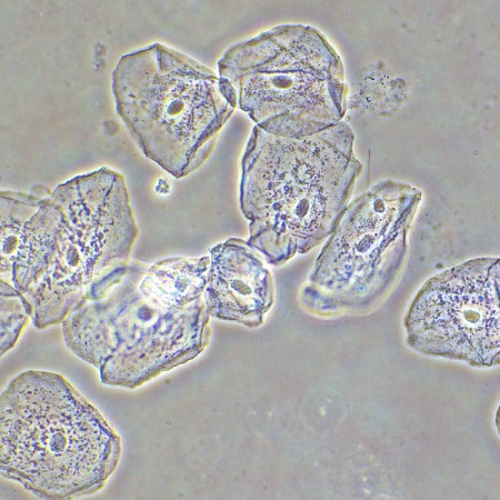 Dispositivo a contrasto di fase magus sph2