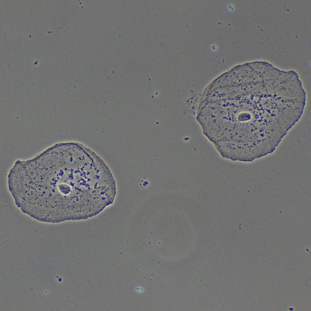 Dispositivo a contrasto di fase magus ph2
