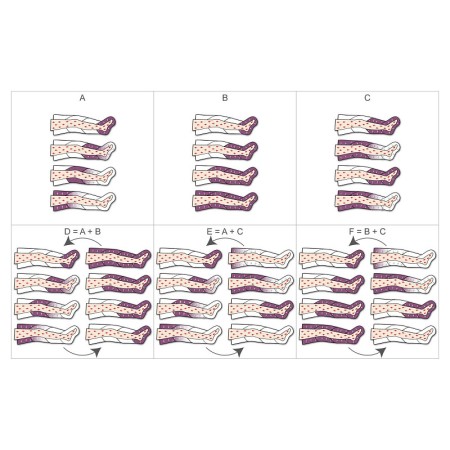 Pressoterapia pressomedical 6.0 pro con 2 gambali + kit slim body + 1 bracciale