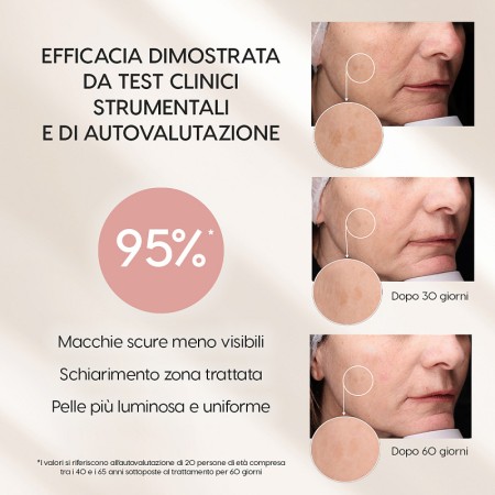Dark spot remedy siero viso schiarente anti-macchie con estratto di foglie di uva ursina e olivo