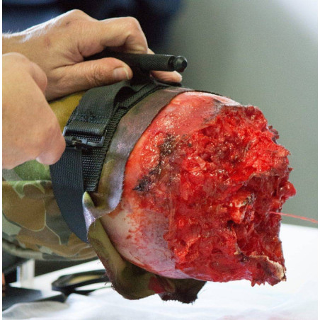 Simulatore medico di emorragia massiva da amputazione