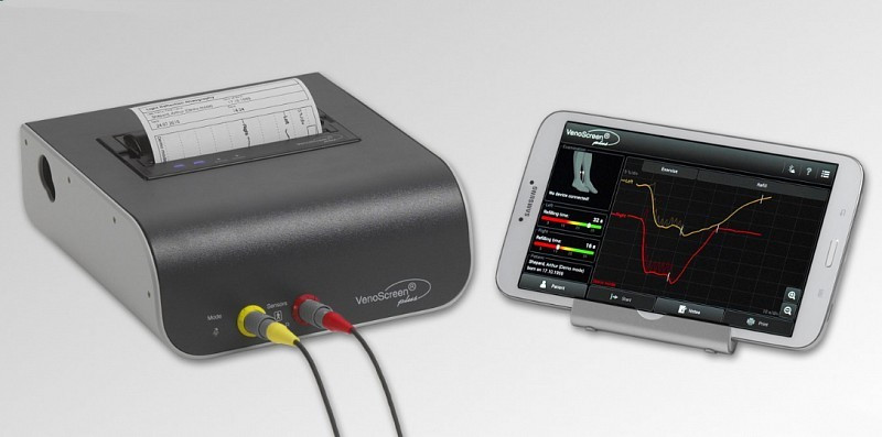 Diagnóstico de insuficiência venosa