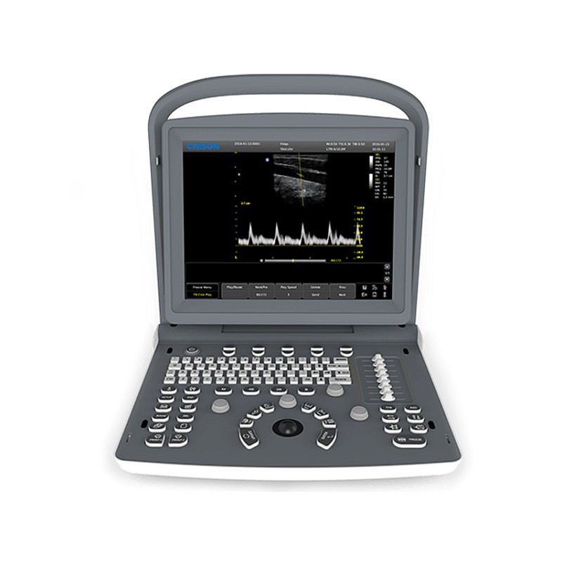 Ecografi-Monitor